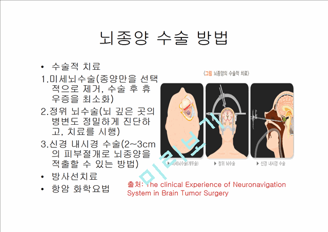 [4000원] 뇌종양종류 및 증상,양성종양 VS 악성종양,뇌종양 수술 방법,뇌종양에 좋은 음식,뇌농양,두부손상,두부손상 응급처치,두부손상에 의한 질환.pptx